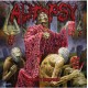 Autopsy-Morbidity Triumphant
